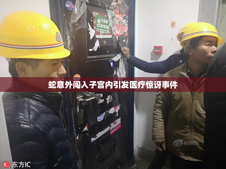蛇意外闯入子宫内引发医疗惊讶事件
