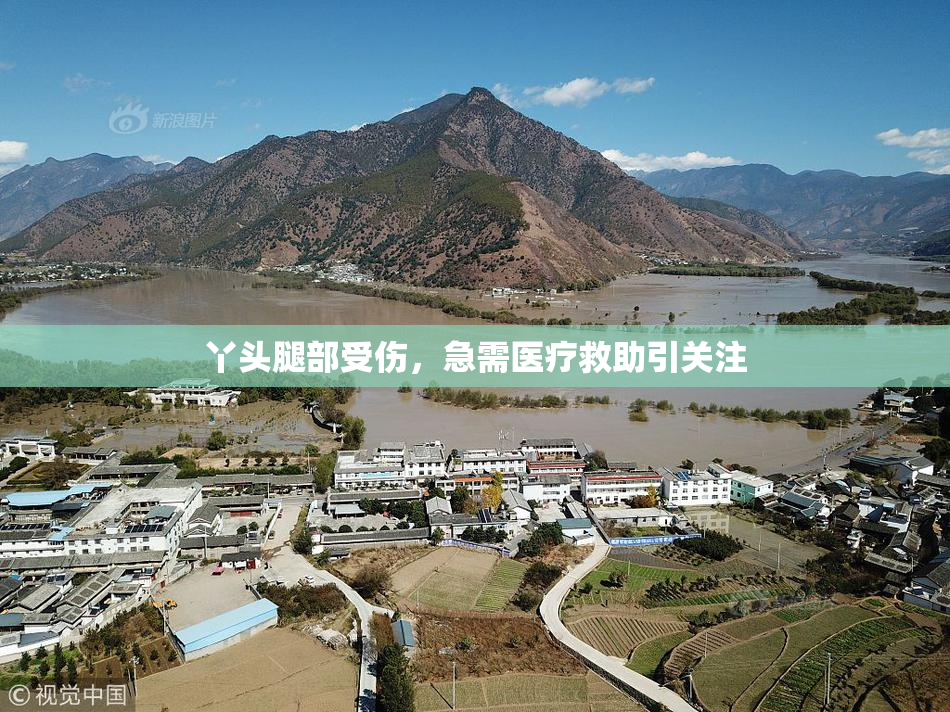 丫头腿部受伤，急需医疗救助引关注