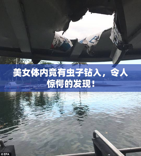 美女体内竟有虫子钻入，令人惊愕的发现！
