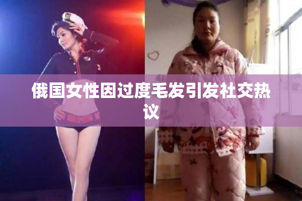 俄国女性因过度毛发引发社交热议