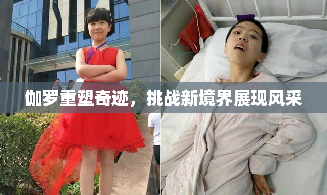 伽罗重塑奇迹，挑战新境界展现风采