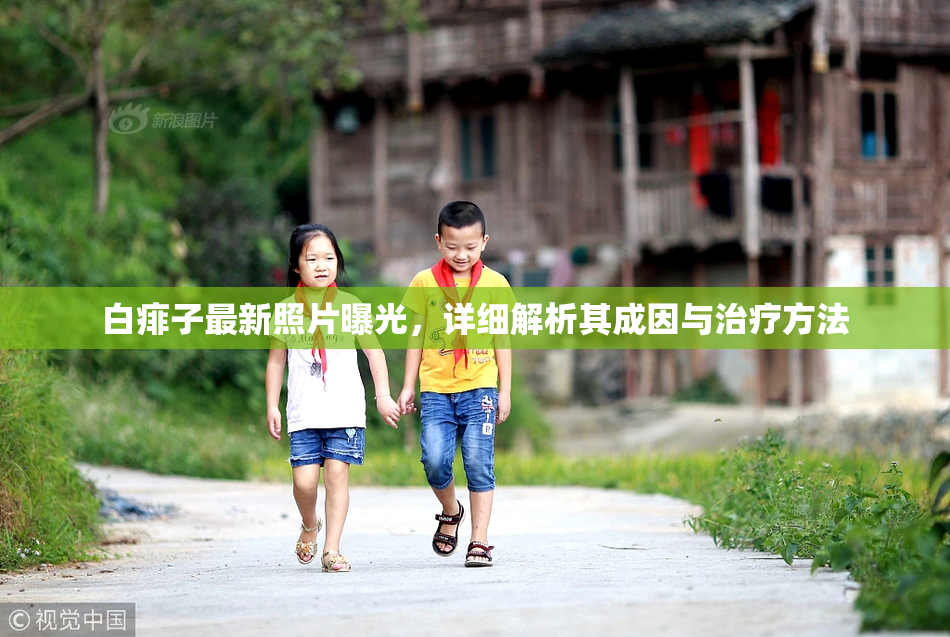 白痱子最新照片曝光，详细解析其成因与治疗方法