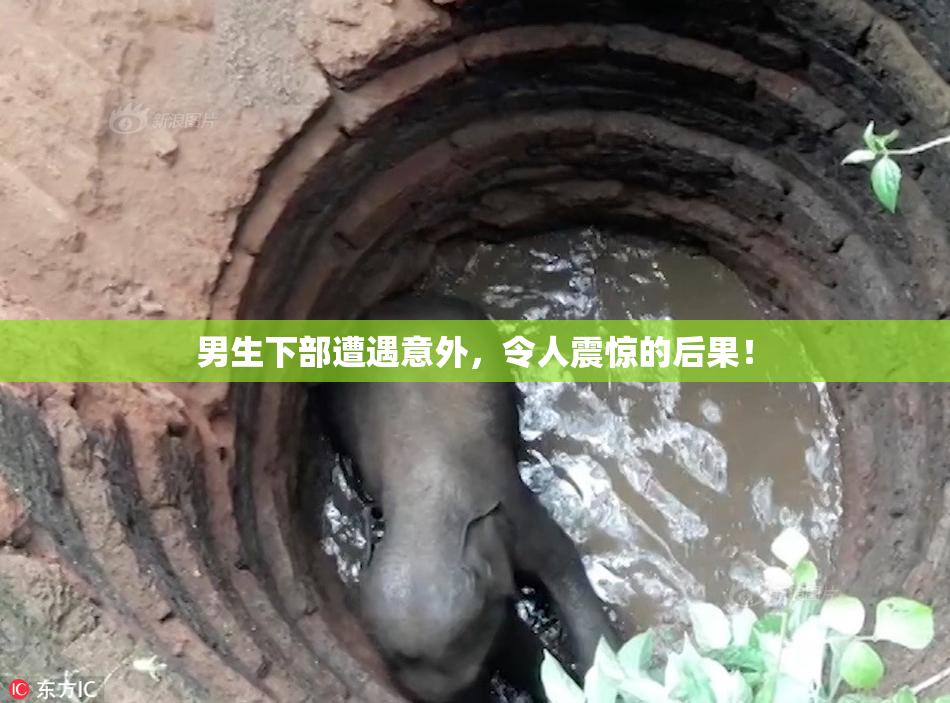 男生下部遭遇意外，令人震惊的后果！